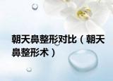 朝天鼻整形对比（朝天鼻整形术）