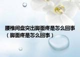 腰椎间盘突出脚面疼是怎么回事（脚面疼是怎么回事）