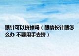 眼针可以挤掉吗（眼睛长针眼怎么办 不要用手去挤）